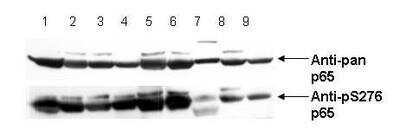 Western Blot: RelA/NFkB p65 [p Ser276] Antibody [NBP1-77807]